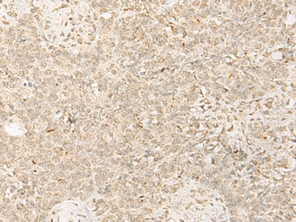 PADI4 Polyclonal Antibody Reactivity Human