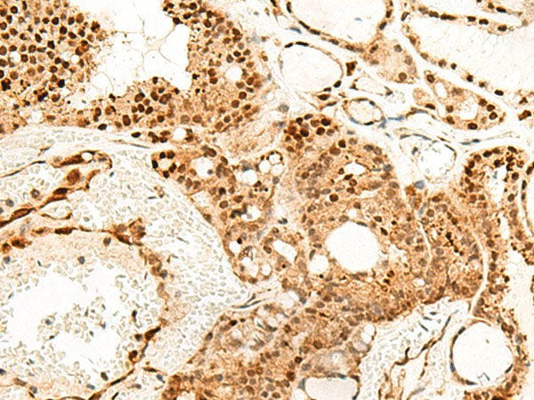 PDCD4 Polyclonal Antibody Reactivity Human
