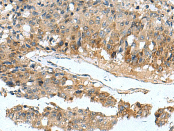 PDCD5 Polyclonal Antibody Reactivity Mouse