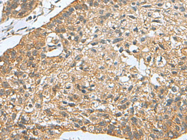 PDCD5 Polyclonal Antibody Reactivity Mouse