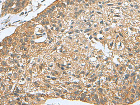 PDCD5 Polyclonal Antibody Reactivity Mouse