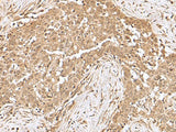 RCHY1 Polyclonal Antibody Reactivity Human