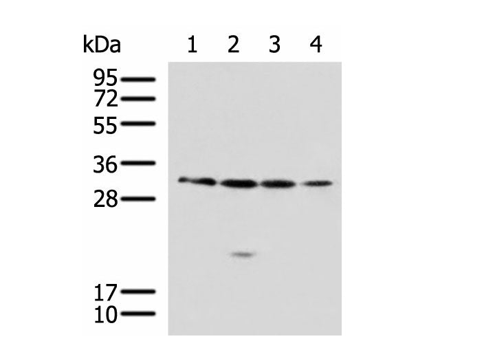 RCHY1 Polyclonal Antibody Reactivity Human