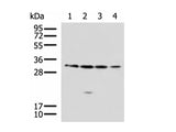 RCHY1 Polyclonal Antibody Reactivity Human