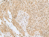 PHF6 Polyclonal Antibody