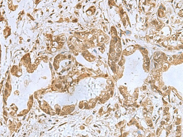 PHF6 Polyclonal Antibody