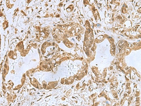 PHF6 Polyclonal Antibody