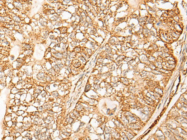 NR0B2 Polyclonal Antibody Reactivity Mouse
