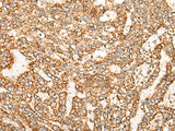 NR0B2 Polyclonal Antibody Reactivity Mouse
