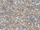 TGFBI Polyclonal Antibody Reactivity Human