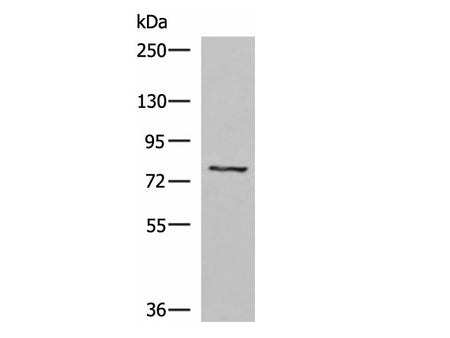 TGFBI Polyclonal Antibody Reactivity Human