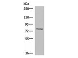 TGFBI Polyclonal Antibody Reactivity Human