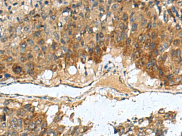 TGM3 Polyclonal Antibody Reactivity Human