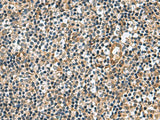 TGM3 Polyclonal Antibody Reactivity Human