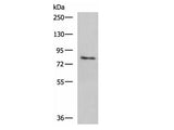 TGM3 Polyclonal Antibody Reactivity Human