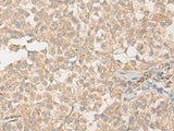 PPM1D Polyclonal Antibody