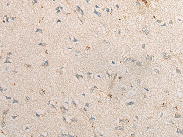 PPM1D Polyclonal Antibody