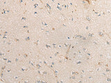 PPM1D Polyclonal Antibody