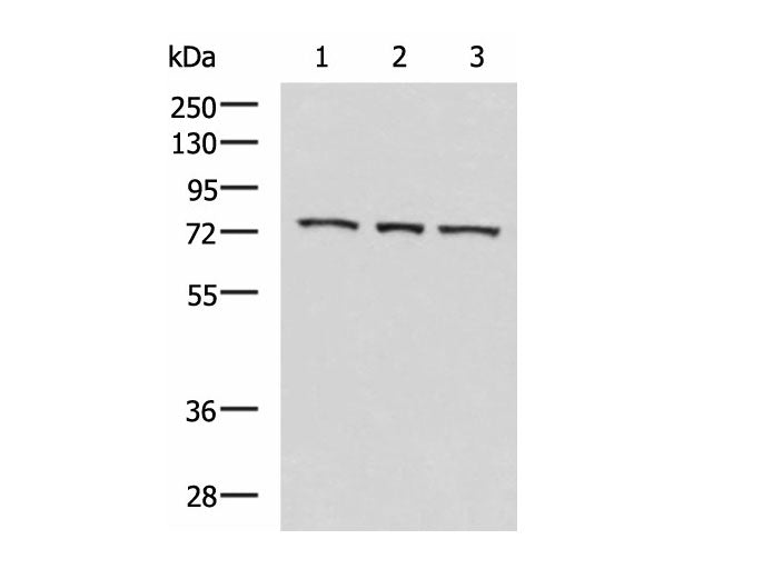 ABI2 Polyclonal Antibody Reactivity Human