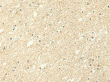 ALPK1 Polyclonal Antibody Reactivity Human