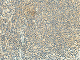 ALPK1 Polyclonal Antibody Reactivity Human