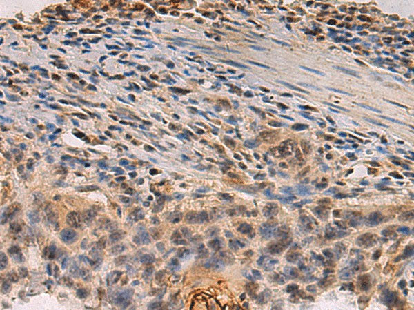 PDS5B Polyclonal Antibody