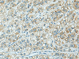 C3AR1 Polyclonal Antibody Reactivity Human