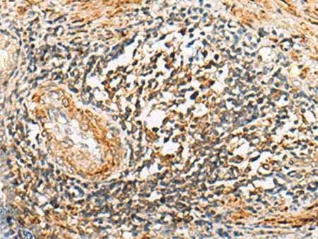 NLRC4 Polyclonal Antibody Reactivity Human