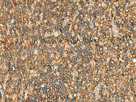 NLRC4 Polyclonal Antibody Reactivity Human