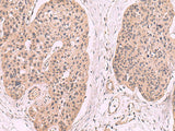 KLRB1 Polyclonal Antibody