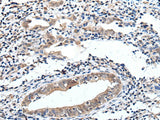ELMO1 Polyclonal Antibody