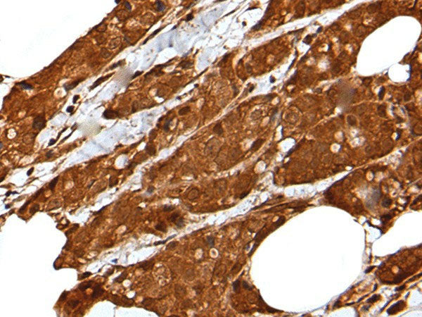 LIPG Polyclonal Antibody Reactivity Human