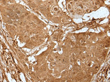 LIPG Polyclonal Antibody Reactivity Human