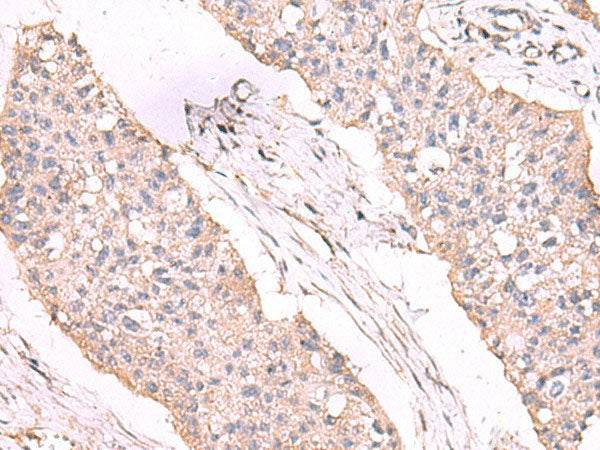 ESM1 Polyclonal Antibody Reactivity Human