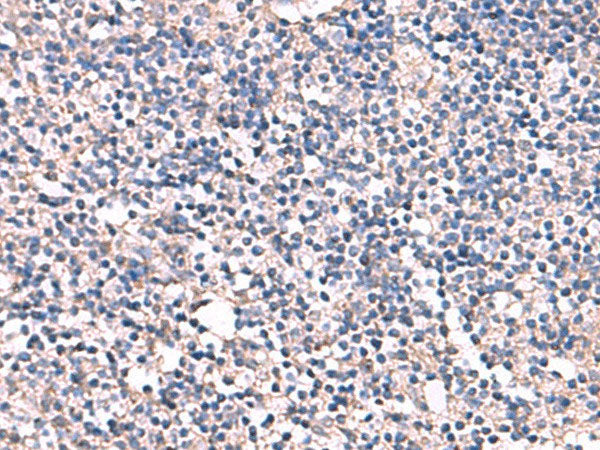 ESM1 Polyclonal Antibody Reactivity Human