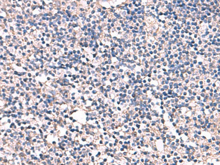ESM1 Polyclonal Antibody Reactivity Human