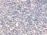ESM1 Polyclonal Antibody Reactivity Human