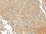 FGL2 Polyclonal Antibody