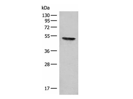 FGL2 Polyclonal Antibody