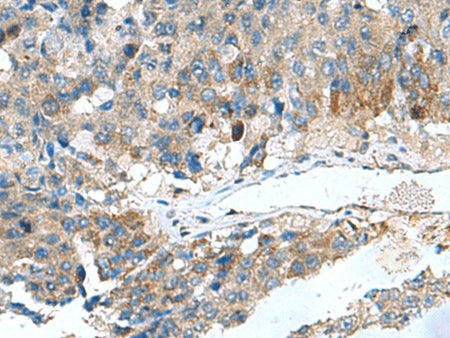 HSD11B1 Polyclonal Antibody Reactivity Human