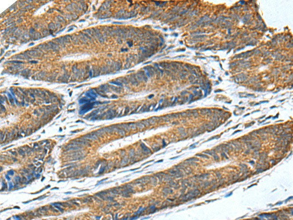 HSD11B1 Polyclonal Antibody Reactivity Human