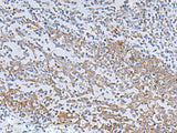 IL22RA2 Polyclonal Antibody