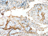 LDHD Polyclonal Antibody Reactivity Human