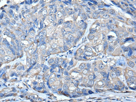 PRKAR2A Polyclonal Antibody