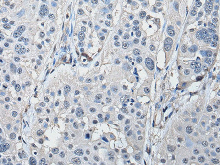 PRKAR2A Polyclonal Antibody