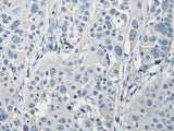 PRKAR2A Polyclonal Antibody