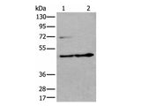 PRKAR2A Polyclonal Antibody