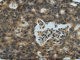 PLTP Polyclonal Antibody