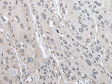 PRAME Polyclonal Antibody
