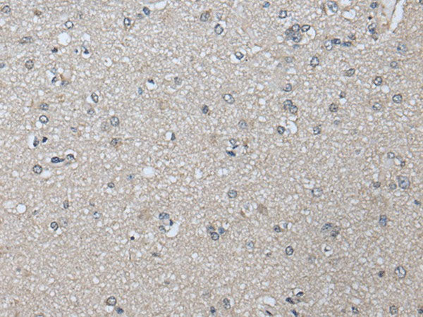 PRAME Polyclonal Antibody